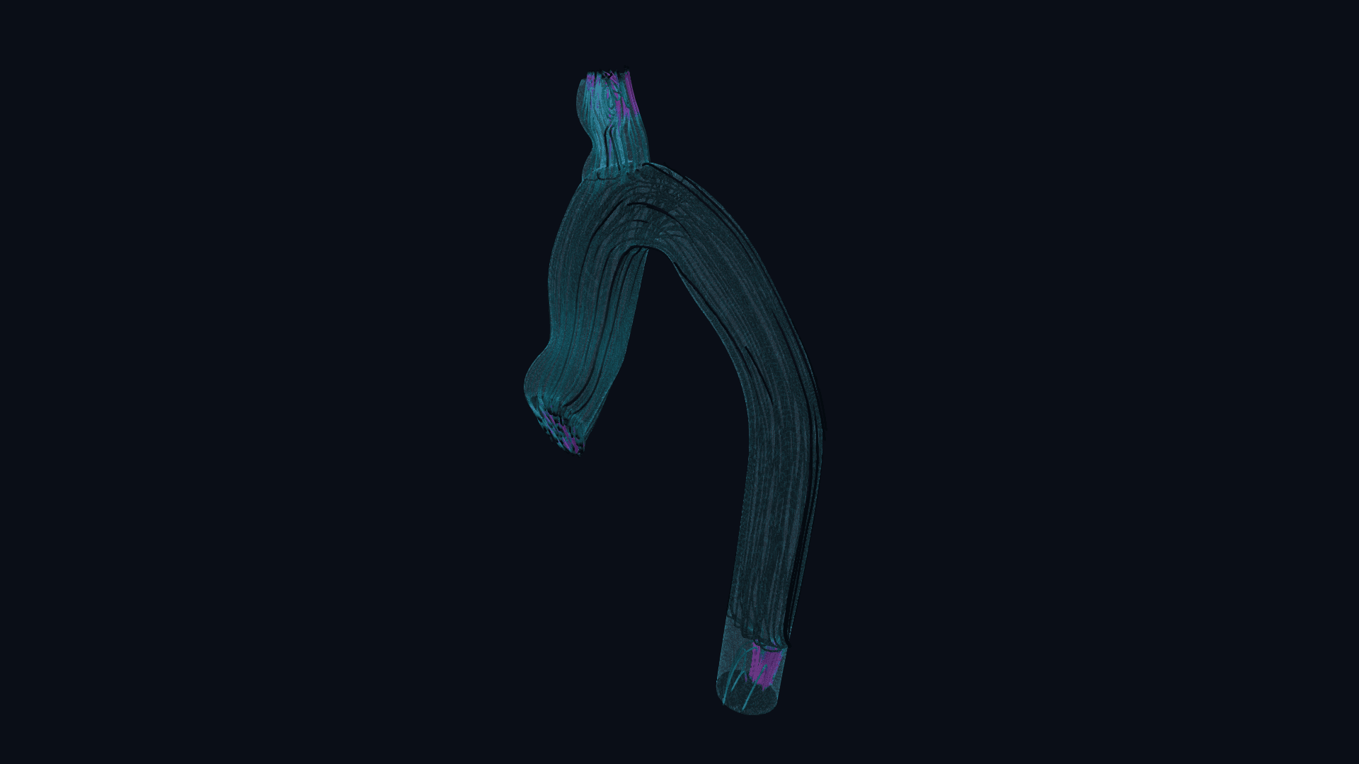 Aorta